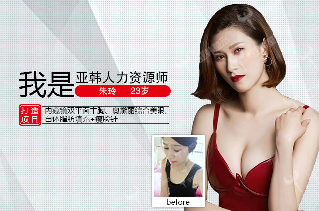 朱玲