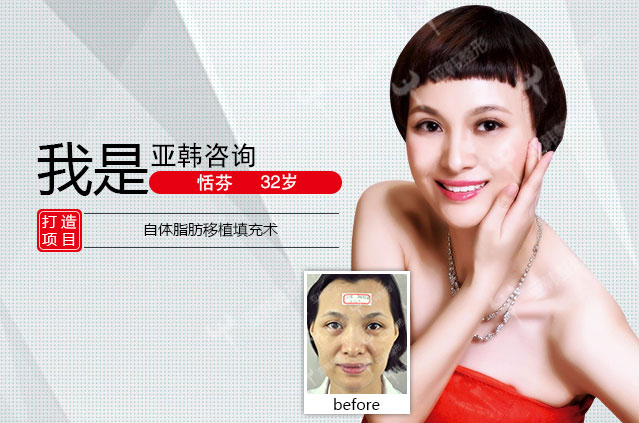 恬芬