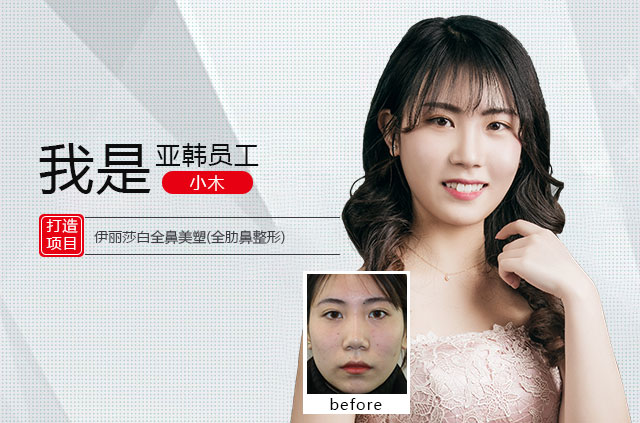 小木