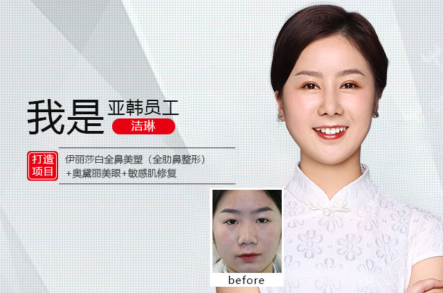 洁琳